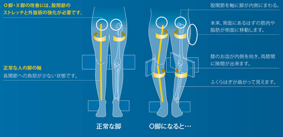 正常な脚と、O脚・X脚の状態とは？
